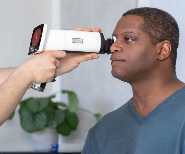 AI Fundus Retinal Camera