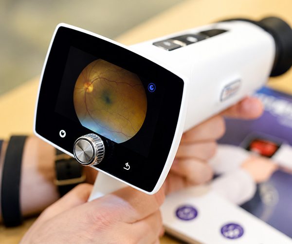 Ai Fundus Camera Vs Traditional Fundus Camera: Key Differences And Benefits Of An Ai Fundus Camera