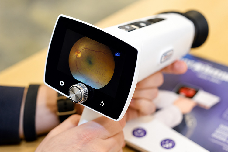 Ai Fundus Camera Vs Traditional Fundus Camera: Key Differences And Benefits Of An Ai Fundus Camera